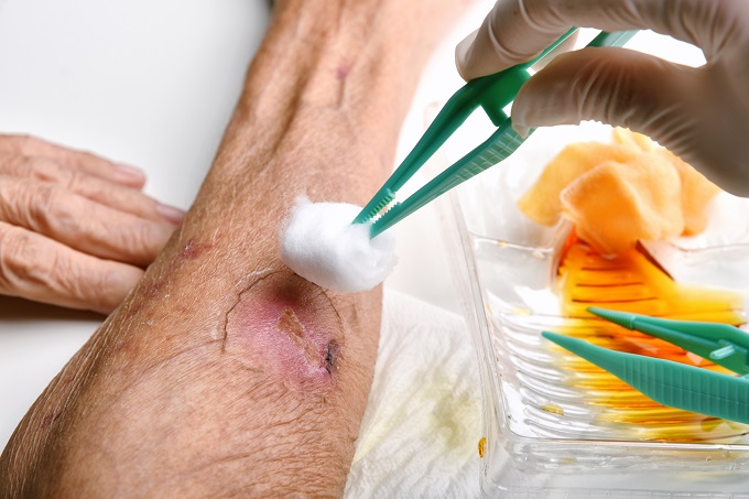 basic-guidelines-in-wound-care